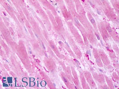 Anti-PTPRA antibody IHC of human heart. Immunohistochemistry of formalin-fixed, paraffin-embedded tissue after heat-induced antigen retrieval. Antibody LS-A6792 dilution 10 ug/ml.