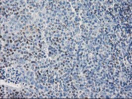 IHC of paraffin-embedded Human lymph node tissue using anti-SULT1C2 mouse monoclonal antibody. (Heat-induced epitope retrieval by 10mM citric buffer, pH6.0, 100C for 10min).