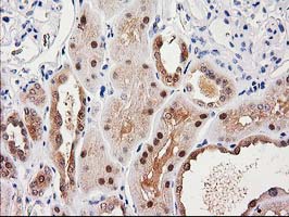 IHC of paraffin-embedded Human Kidney tissue using anti-SULT1C2 mouse monoclonal antibody.