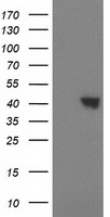 HEK293T cells were transfected with the pCMV6-ENTRY control (Left lane) or pCMV6-ENTRY SULT1C2 (Right lane) cDNA for 48 hrs and lysed. Equivalent amounts of cell lysates (5 ug per lane) were separated by SDS-PAGE and immunoblotted with anti-SULT1C2.