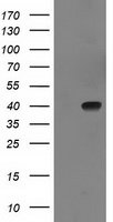 HEK293T cells were transfected with the pCMV6-ENTRY control (Left lane) or pCMV6-ENTRY SULT1C2 (Right lane) cDNA for 48 hrs and lysed. Equivalent amounts of cell lysates (5 ug per lane) were separated by SDS-PAGE and immunoblotted with anti-SULT1C2.
