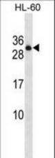 PTPRCAP Antibody western blot of HL-60 cell line lysates (35 ug/lane). The PTPRCAP antibody detected the PTPRCAP protein (arrow).