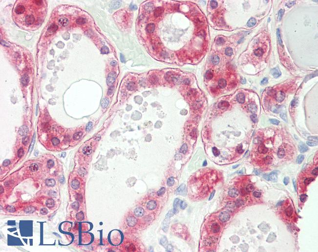 Anti-SULT1C2 antibody IHC staining of human thyroid. Immunohistochemistry of formalin-fixed, paraffin-embedded tissue after heat-induced antigen retrieval. Antibody LS-B10965 dilution 1:50.