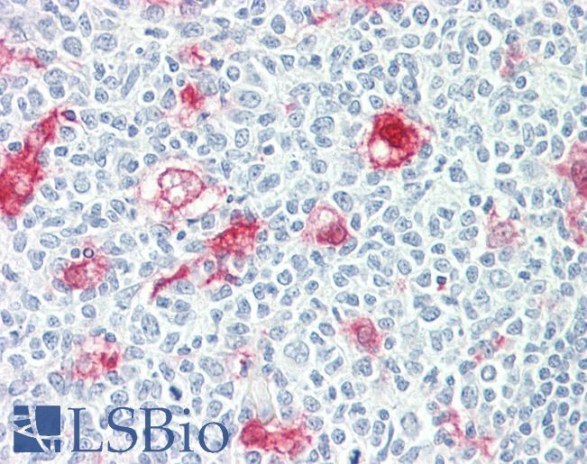 Anti-SULT1C2 antibody IHC staining of human tonsil. Immunohistochemistry of formalin-fixed, paraffin-embedded tissue after heat-induced antigen retrieval.
