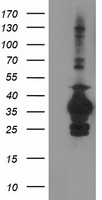 HEK293T cells were transfected with the pCMV6-ENTRY control (Left lane) or pCMV6-ENTRY SULT1C2 (Right lane) cDNA for 48 hrs and lysed. Equivalent amounts of cell lysates (5 ug per lane) were separated by SDS-PAGE and immunoblotted with anti-SULT1C2.