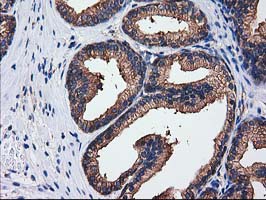 IHC of paraffin-embedded Human prostate tissue using anti-SULT1C2 mouse monoclonal antibody. (Heat-induced epitope retrieval by 10mM citric buffer, pH6.0, 100C for 10min).