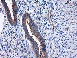 IHC of paraffin-embedded Human endometrium tissue using anti-SULT1C2 mouse monoclonal antibody. (Heat-induced epitope retrieval by 10mM citric buffer, pH6.0, 100C for 10min).