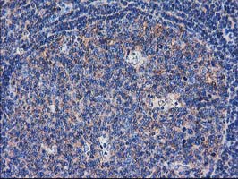 IHC of paraffin-embedded Human lymph node tissue using anti-SULT1C2 mouse monoclonal antibody. (Heat-induced epitope retrieval by 10mM citric buffer, pH6.0, 100C for 10min).