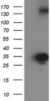 HEK293T cells were transfected with the pCMV6-ENTRY control (Left lane) or pCMV6-ENTRY SULT1C2 (Right lane) cDNA for 48 hrs and lysed. Equivalent amounts of cell lysates (5 ug per lane) were separated by SDS-PAGE and immunoblotted with anti-SULT1C2.