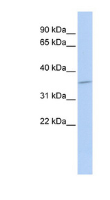 SULT1C4 antibody LS-C102316 Western blot of MCF7 cell lysate.