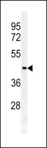 Western blot of SULT2B1a/b antibody in HL60 cell line lysates (35 ug/lane). SULT2B1a/b (arrow) was detected using the purified antibody.