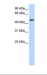 Transfected 293T cell lysate. Antibody concentration: 1.0 ug/ml. Gel concentration: 12%.