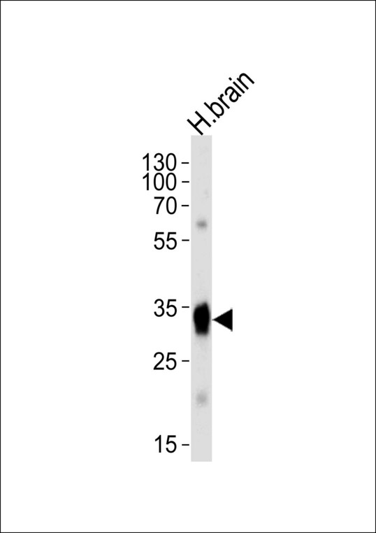 Western blot of lysate from human brain tissue lysate, using SULT4A1a/b Antibody (M1). Antibody was diluted at 1:1000 at each lane. A goat anti-rabbit IgG H&L (HRP) at 1:5000 dilution was used as the secondary antibody. Lysate at 35ug per lane.