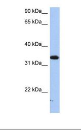 HepG2 cell lysate. Antibody concentration: 1.0 ug/ml. Gel concentration: 12%.