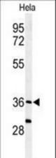 Western blot of SUMF1 Antibody in HeLa cell line lysates (35 ug/lane). SUMF1 (arrow) was detected using the purified antibody.