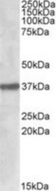 SUMF1 antibody (1 ug/ml) staining of Mouse Pancreas lysate (35 ug protein/ml in RIPA buffer). Primary incubation was 1 hour. Detected by chemiluminescence.