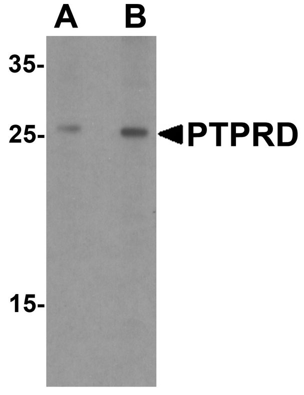 Western blot analysis of PTPRD in HeLa cell lysate with PTPRD antibody at (A) 1 and (B) 2 ug/ml.