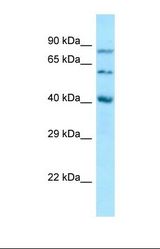 Western blot of Human PANC1 Whole cell. SUMF1 antibody dilution 1.0 ug/ml.