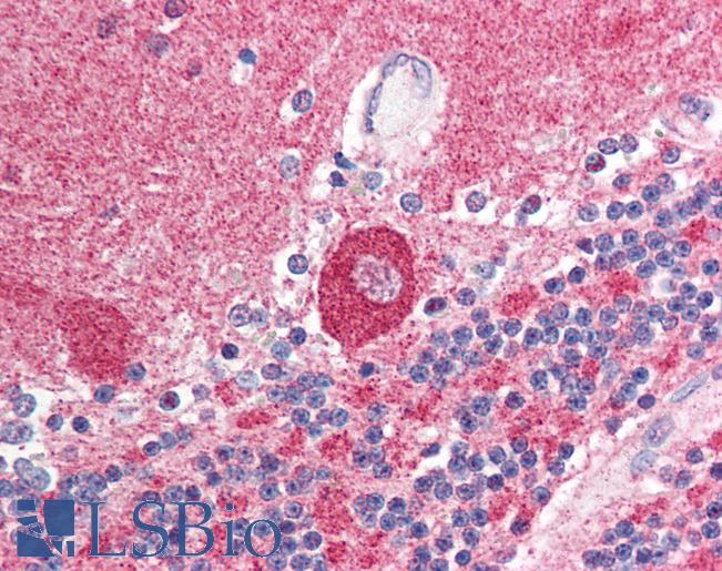 Anti-SUMO1 antibody IHC of human brain, cerebellum. Immunohistochemistry of formalin-fixed, paraffin-embedded tissue after heat-induced antigen retrieval. Antibody LS-B594 concentration 5 ug/ml.