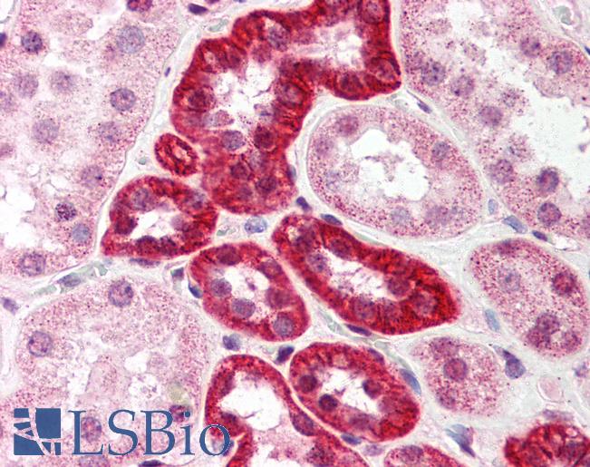 Anti-SUMO1 antibody IHC of human kidney. Immunohistochemistry of formalin-fixed, paraffin-embedded tissue after heat-induced antigen retrieval. Antibody LS-B594 concentration 5 ug/ml.