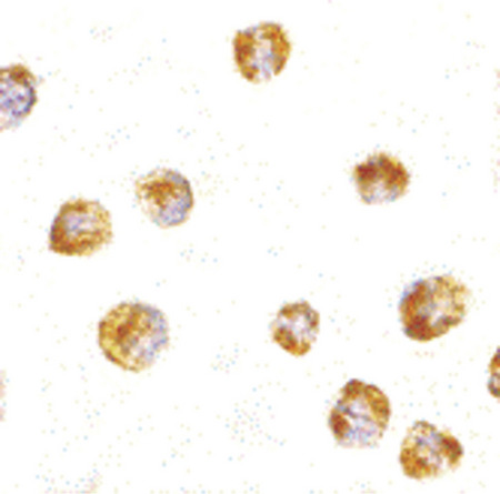 Immunocytochemistry of Sumo in HL60 cells with Sumo antibody at 5 ug/ml.