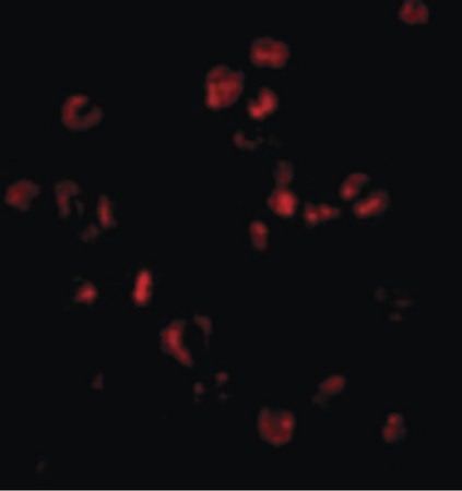 Immunofluorescence of Sumo in HL60 cells with Sumo antibody at 20 ug/ml.