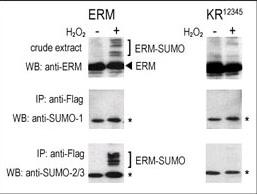 COS-7 cells were transfected for 24 hrs with a plasmid expressing FLAG-ERM (left panels) or FLAG-ERM KR12345 (right panels). Untreated (-) and H2O2-treated (+) cells were collected for immunoblot analysis. Top panels: cell lysates probed by western blot (WB) with an anti-ERM antibody. Center panels: cell lysates immunoprecipitated (IP) with an anti-FLAG antibody followed by WB SUMO-1 antibody. Bottom panels: cell lysates immunoprecipitated with an anti-FLAG antibody followed by WB with SUMO-2/3 antibody. (*) represents immunoprecipitated ERM-like forms recognized by anti-SUMO antibodies.
