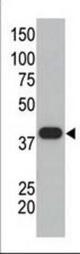 The anti-SUMO1 polyclonal antibody is used in Western blot to detect GST-SUMO1 fusion protein.