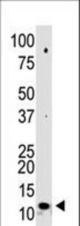 Western blot of anti-SUMO2/3 N-term polyclonal antibody in 293 cell lysate. Sumo2/3 (arrow) was detected using purified antibody. Secondary HRP-anti-rabbit was used for signal visualization with chemiluminescence.