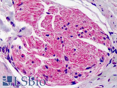 Anti-SUMO2/SUMO3 antibody IHC of human adrenal. Immunohistochemistry of formalin-fixed, paraffin-embedded tissue after heat-induced antigen retrieval. Antibody LS-B4753 concentration 5 ug/ml.