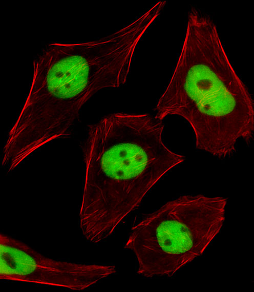 Fluorescent image of U251 cells stained with SUMO2/3 Antibody. Antibody was diluted at 1:25 dilution. An Alexa Fluor 488-conjugated goat anti-rabbit lgG at 1:400 dilution was used as the secondary antibody (green). Cytoplasmic actin was counterstained with Alexa Fluor 555 conjugated with Phalloidin (red).