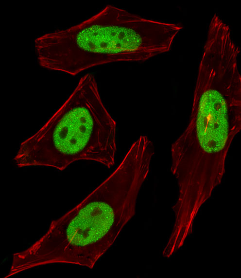 Fluorescent image of HeLa cells stained with SUMO2/3 Antibody. Antibody was diluted at 1:100 dilution. An Alexa Fluor 488-conjugated goat anti-rabbit lgG at 1:400 dilution was used as the secondary antibody (green). Cytoplasmic actin was counterstained with Alexa Fluor 555 conjugated with Phalloidin (red).
