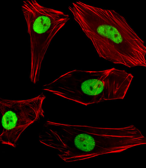 Fluorescent image of SH-SY5Y cells stained with SUMO2/3 Antibody. Antibody was diluted at 1:100 dilution. An Alexa Fluor 488-conjugated goat anti-rabbit lgG at 1:400 dilution was used as the secondary antibody (green). Cytoplasmic actin was counterstained with Alexa Fluor 555 conjugated with Phalloidin (red).