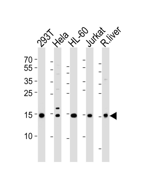 Western blot of lysates from 293T, HeLa, HL-60, Jurkat cell lines and rat liver tissue lysate (from left to right), using SUMO2/3 Antibody (Q65). Antibody was diluted at 1:1000 at each lane. A goat anti-rabbit IgG H&L (HRP) at 1:5000 dilution was used as the secondary antibody. Lysates at 35ug per lane.