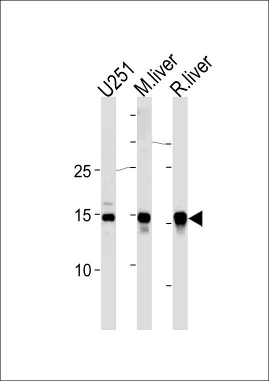 SUMO2/3 Antibody western blot of U251 cell lysate,mouse liver and rat liver tissue lysates (35 ug/lane). This demonstrates that the SUMO2/3 antibody detected SUMO2/3 protein (arrow).