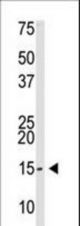 The anti-SUMO2/3 antibody is used in Western blot to detect SUMO2/3 in Saos-2 cell lysate.