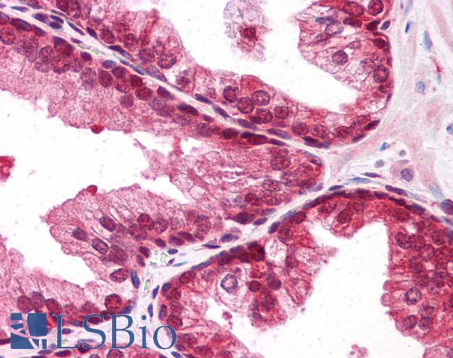 Anti-SUMO2/SUMO3 antibody IHC of human prostate. Immunohistochemistry of formalin-fixed, paraffin-embedded tissue after heat-induced antigen retrieval. Antibody LS-B5093 concentration 5 ug/ml.