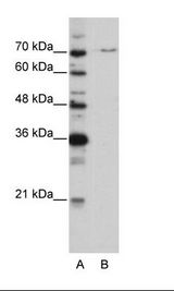 A: Marker, B: HepG2 Cell Lysate