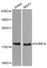 Western blot analysis of extracts of various cell lines, using SUMO4 antibody.