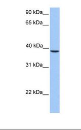 HepG2 cell lysate. Antibody concentration: 1.0 ug/ml. Gel concentration: 12%.
