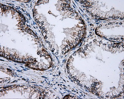 IHC of paraffin-embedded prostate tissue using anti-PTPRE mouse monoclonal antibody. (Dilution 1:50).