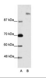 A: Marker, B: Jurkat Cell Lysate
