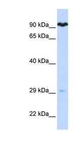 SUPV3L1 antibody LS-C101626 Western blot of Fetal Muscle lysate.