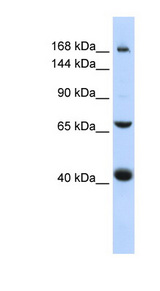 ABCC9 antibody LS-C102047 Western blot of 721_B cell lysate.