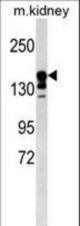 ABCC9 Antibody western blot of mouse kidney tissue lysates (35 ug/lane). The ABCC9 Antibody detected the ABCC9 protein (arrow).