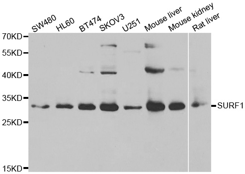 Western blot analysis of extracts of various cell lines, using SURF1 antibody.