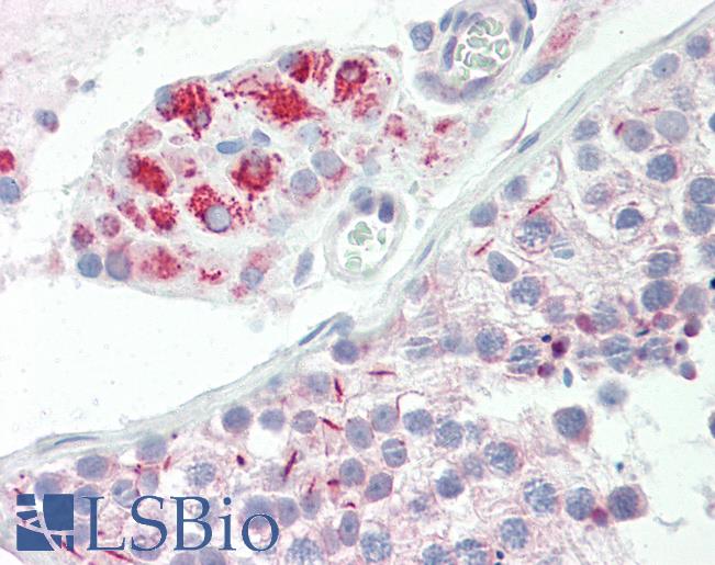 Anti-SURF1 antibody IHC staining of human testis. Immunohistochemistry of formalin-fixed, paraffin-embedded tissue after heat-induced antigen retrieval. Antibody LS-B9956 concentration 10 ug/ml.