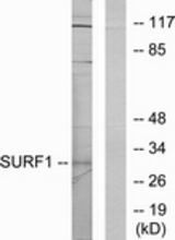 Western blot of extracts from Jurkat cells, using SURF1 Antibody. The lane on the right is treated with the synthesized peptide.