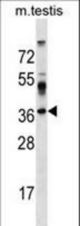 SURF4 Antibody western blot of mouse testis tissue lysates (35 ug/lane). The SURF4 antibody detected the SURF4 protein (arrow).
