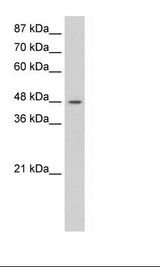 Jurkat Cell Lysate